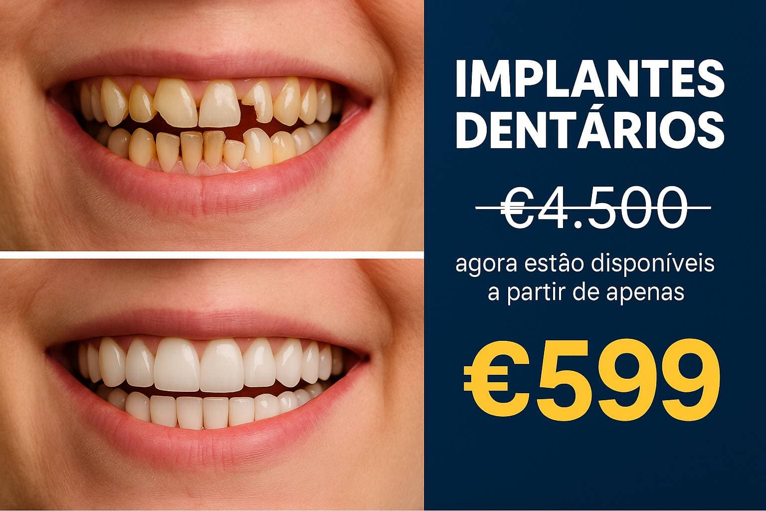 €4.500 Cortado | Implantes Dentários...